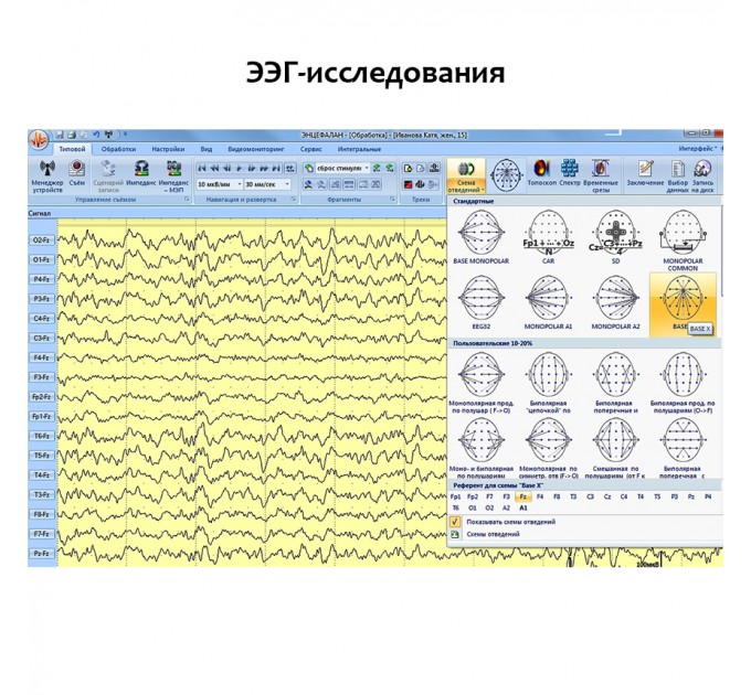 Электроэнцефалограф - регистратор Энцефалан - ЭЭГР -19/26 в Караганде