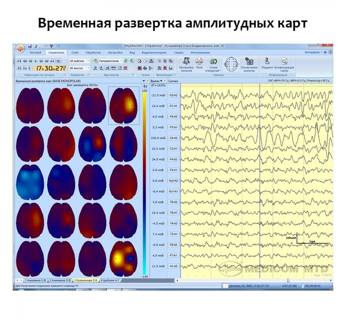 Электроэнцефалограф - регистратор Энцефалан - ЭЭГР -19/26 в Караганде