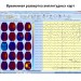 Электроэнцефалограф - регистратор Энцефалан - ЭЭГР -19/26 в Караганде