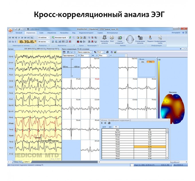 Электроэнцефалограф - регистратор Энцефалан - ЭЭГР -19/26 в Караганде