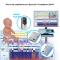 Монитор церебральных функций «Энцефалан-ЦФМ» в Караганде