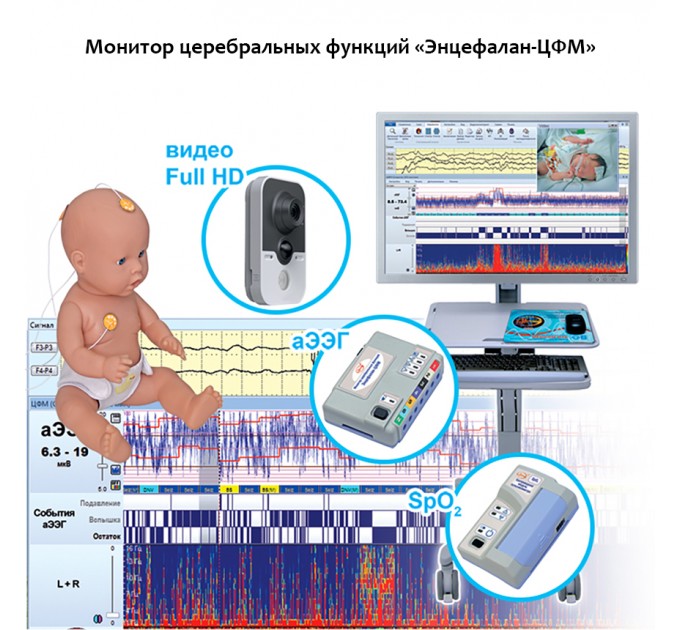 Монитор церебральных функций «Энцефалан-ЦФМ» в Караганде