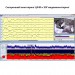 Монитор церебральных функций «Энцефалан-ЦФМ» в Караганде
