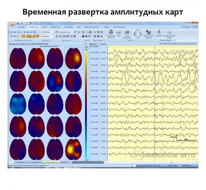 Электроэнцефалограф - регистратор Энцефалан - ЭЭГР -19/26 Модификация «Мини» в Караганде
