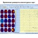 Электроэнцефалограф - регистратор Энцефалан - ЭЭГР -19/26 Модификация «Мини» в Караганде