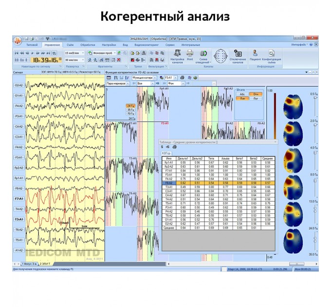 Электроэнцефалограф - регистратор Энцефалан - ЭЭГР -19/26 Модификация «Мини» в Караганде