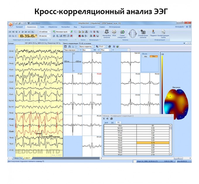 Электроэнцефалограф - регистратор Энцефалан - ЭЭГР -19/26 Модификация «Мини» в Караганде