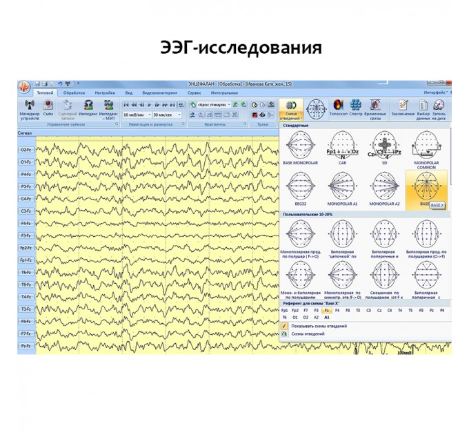 Электроэнцефалограф - регистратор Энцефалан - ЭЭГР -19/26 Модификация «Мини» в Караганде
