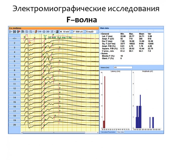 Нейромиоанализатор НМА-4-01 Нейромиан для ЭМГ и ВП исследований в Караганде