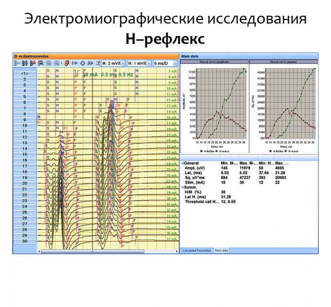 Нейромиоанализатор НМА-4-01 Нейромиан для ЭМГ и ВП исследований в Караганде
